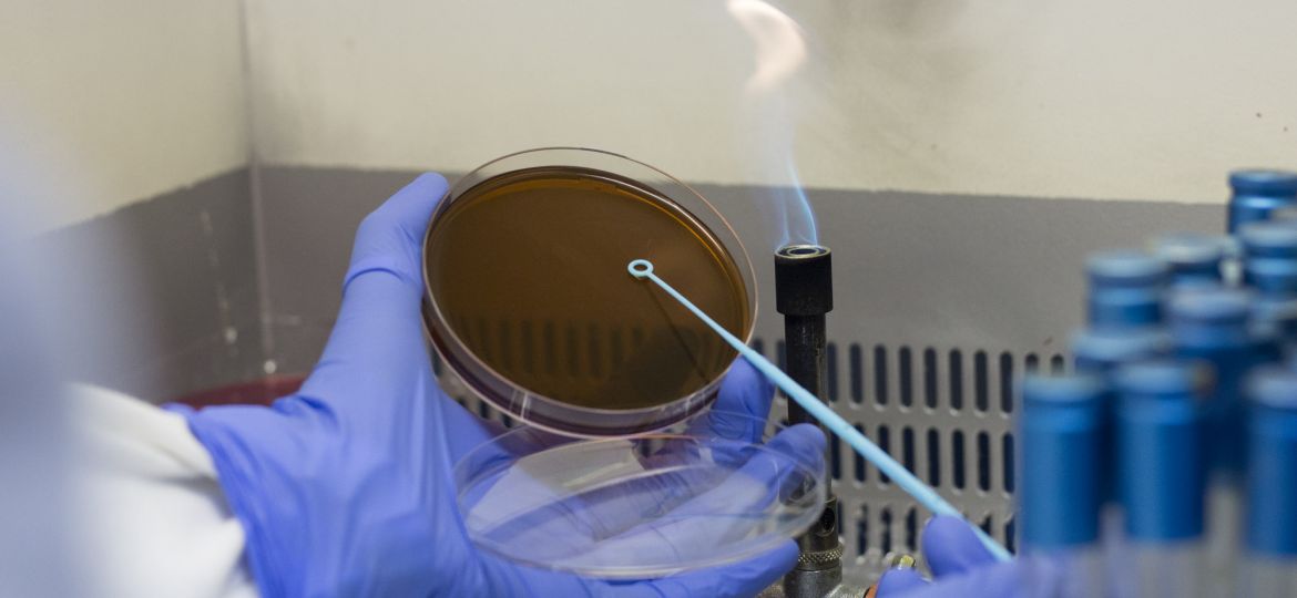 control de legionella