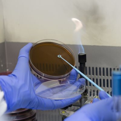 control de legionella