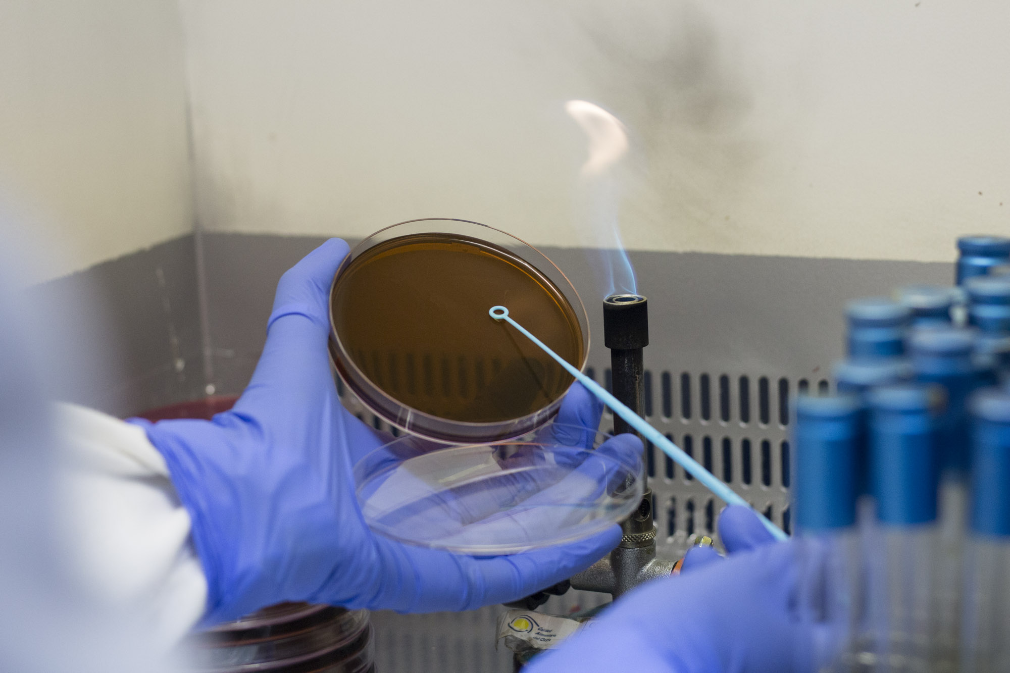 control de legionella